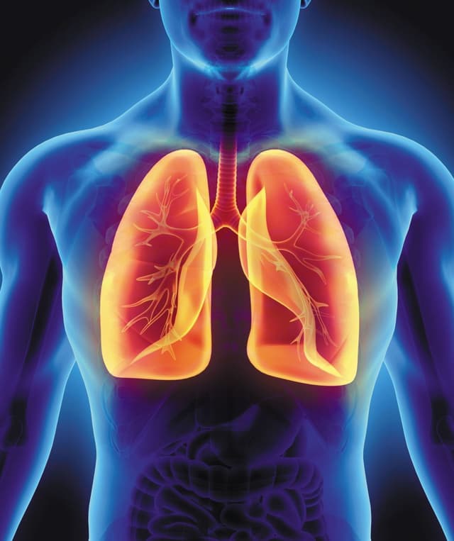 Tuberculosis Image
